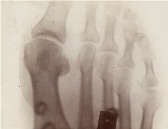 (X-RAYS) A small archive of 14 X-rays and related imagery documenting early use of the technology at Wesleyan University.